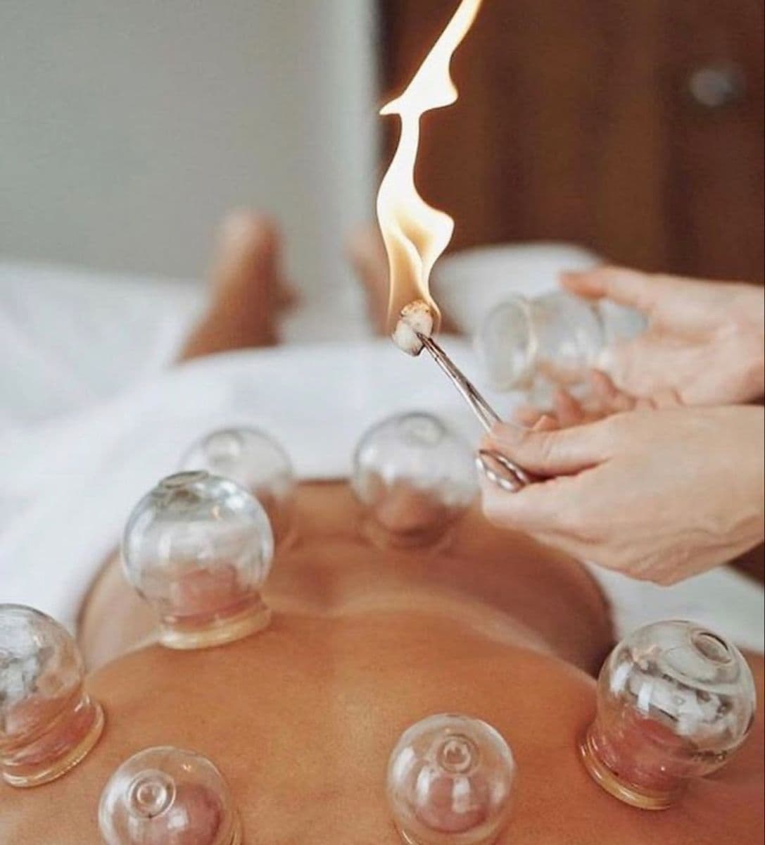 Fire/Ventosa/Moxa Cupping