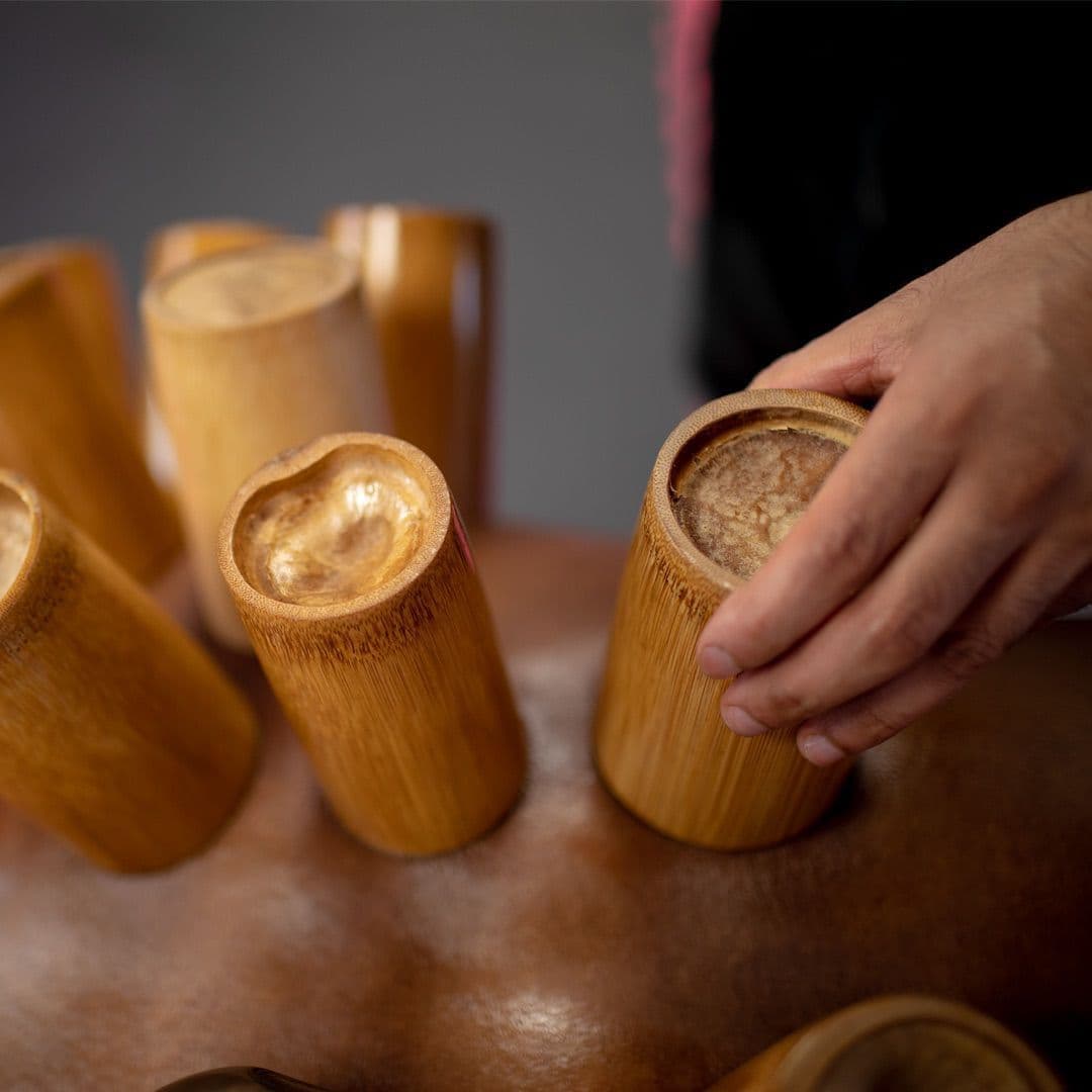 Hijama (Wet Cupping)