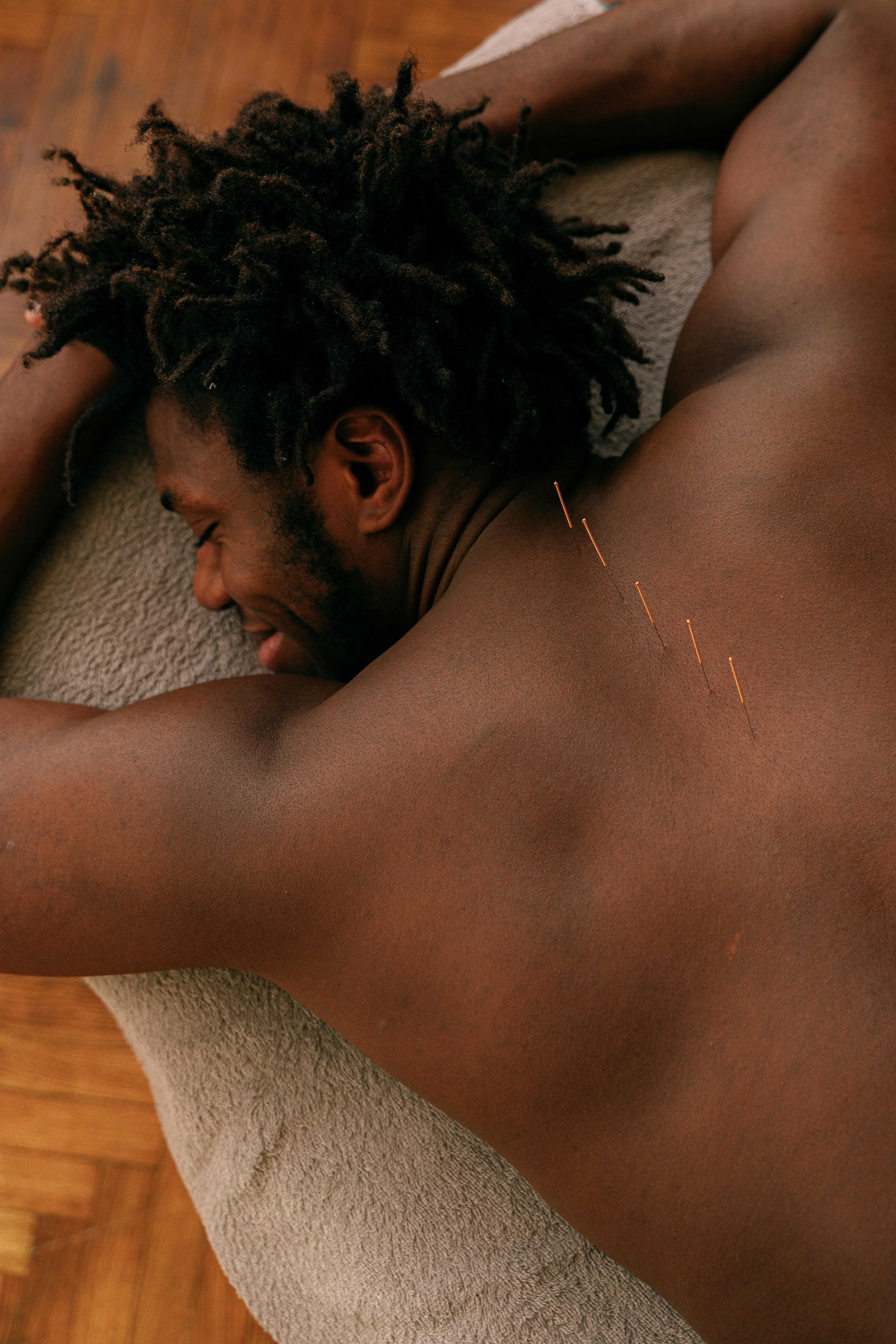 Needling & Cupping